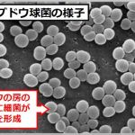鼻ニキビの原因は黄色ブドウ球菌