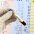 赤血球分布幅（RDW）が炎症性腸疾患の評価に役立つ可能性