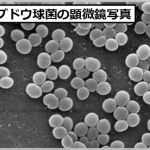 黄色ブドウ球菌