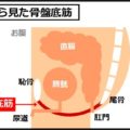 胃下垂の治し方は骨盤底筋を強化することがキモ