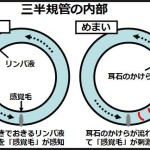 良性発作性頭位めまい症