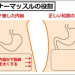 胃下垂の治し方