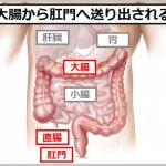 食物繊維で便が詰まる