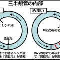 めまいの原因の「耳石」のかけら