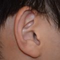 聴力検査で高さの違う2種の音を聞かされる理由