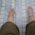 足底腱膜炎(そくていけんまくえん)の治療法