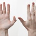 毛細血管が消える「ゴースト血管」のチェック法