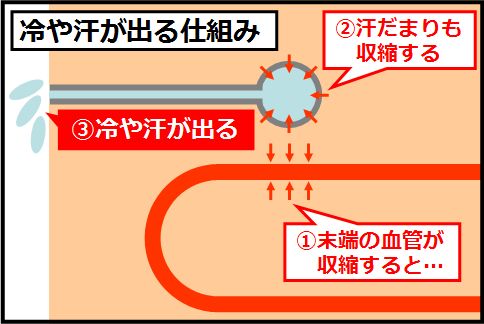 冷や汗がム痛性心筋梗塞で出る仕組み