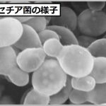 マラセチア菌