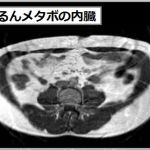 ぷるるんメタボ