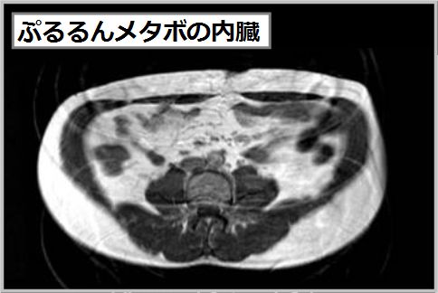 ぷるるんメタボの内臓写真