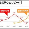 微小血管狭心症は40代にピーク