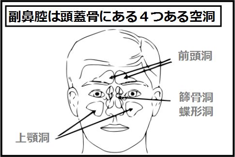 好酸球性副鼻腔炎がおこる場所