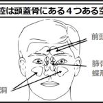 片方だけの鼻水