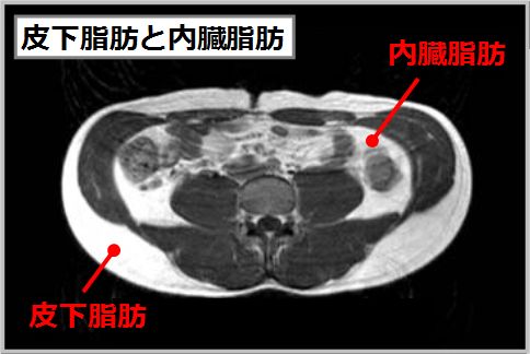 皮下脂肪の落とし方は「つまんで燃焼させる」