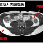 内臓脂肪と皮下脂肪
