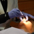 歯周病とは歯槽膿漏！体全体が不健康になる病気