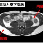 内臓脂肪