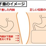 内臓下垂